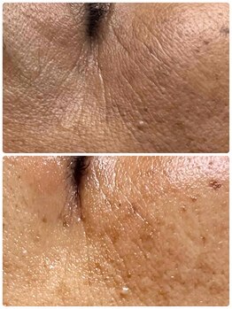 ローズ 下松(ROSE)/くすみや小じわが気になる