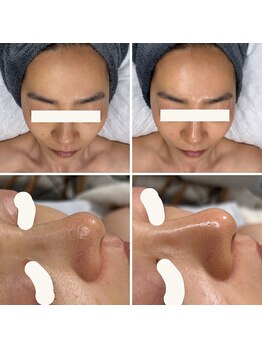 ビオエル(Bioell)/速攻ツヤ肌♪♪