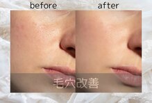 クレール グラン エステ