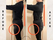 ヨサパーク シアー(YOSA PARK sheer)の雰囲気（食事制限・運動なし施術開始から5回目の変化）