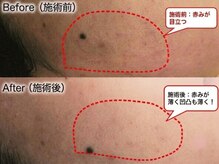 エステサロン エクラの雰囲気（#たるみ　#小顔　#リフトアップ　#ラジオ波　#リンパマッサージ）