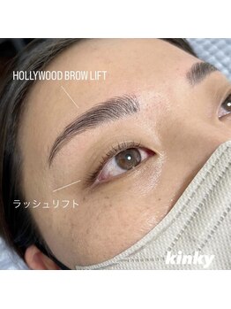 キンキー 広島(kinky)/