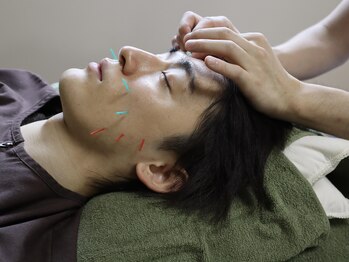 泉町鍼灸整骨院/男性にも美容鍼をご提供