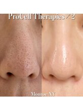 温(on)/プロセルセラピーズフェイシャル