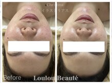 ルルボーテ(Loulou Beaute)/イラストリアス