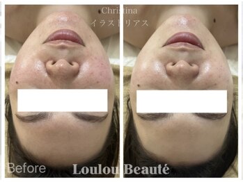 ルルボーテ(Loulou Beaute)/イラストリアス