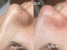 ルチア 美顔秘密基地(Lucia)/ごっそり毛穴洗浄