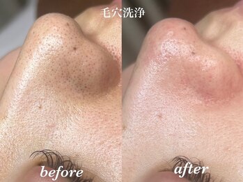 ルチア 美顔秘密基地(Lucia)/ごっそり毛穴洗浄