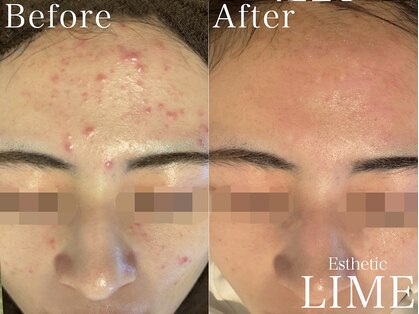 ライム 武庫之荘(LIME)の写真