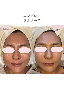 ソワ 恵比寿(soi)/エンビロンフルコース