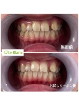 ルブラン 奈良店(Le Blanc)/お得なキャンペーン！