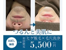 メンズミーシェ(Men's Meshie)