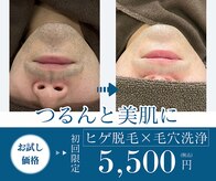 メンズミーシェ(Men's Meshie)