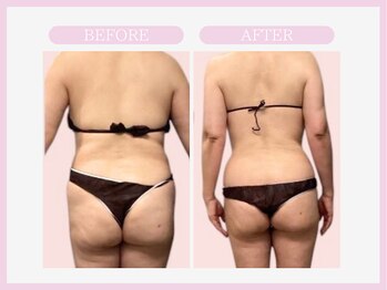 スリムライン 弘前店(The Slim Line)/before→after