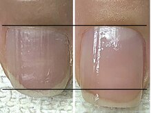 カランコエ(Kalanchoe)/地爪育成