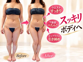 レフアの写真/自己流ダイエットもエステも卒業。落ちにくい脂肪を集中ケア◎結果重視の脂肪燃焼マシン痩身★温熱マット付