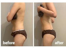 サロンシファ(salon sifa)/上半身インディバ