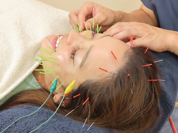 ノア鍼灸整骨院(NOA鍼灸整骨院)/