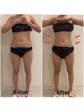 スペチアーレ 夙川/湘南や品川でも大人気【脂肪冷却