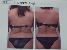 リンエステティック(凜ESTHETIC)/