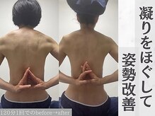 トレス(Tres)の雰囲気（肩こりや埋もれた肩甲骨をインディバとハンドでほぐして姿勢改善）