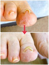 一宮巻き爪センター/巻き爪