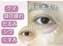 ラフィーユ 南風原店(Lafille)