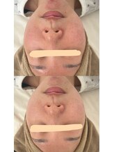 サロンモア(salon More)/LED美容