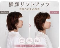 リフェイス(RE:FACE)