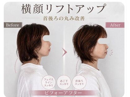 リフェイス(RE:FACE)の写真