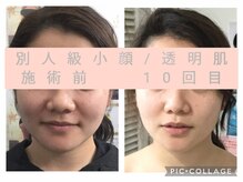 エクラ(Eclat)/小顔+肌質改善+たるみケア専門