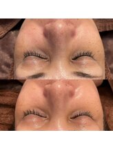 アンバー(amber)/くすみ改善！血行促進で更に美！