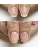 マリーロール 天王寺店(Marie Laure)/自爪育成/深爪矯正/ネイルケア