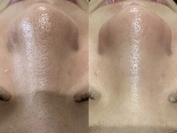 オリエンス(oriens)/