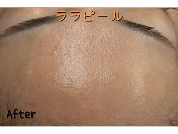 ダイヤモンド リーエンダ(Diamond leende)/ララピール