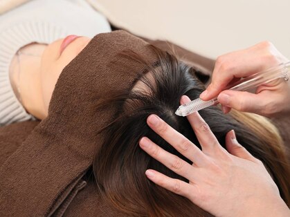 スーパースカルプ 難波店(SuperScalp)の写真