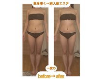 ボンヌシャンスビューティ