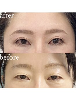 デルタヌー(deltanuu)の写真/目元と眉を整えて、自然体なのに惹かれる私へ
頑張りすぎない上品な垢抜け