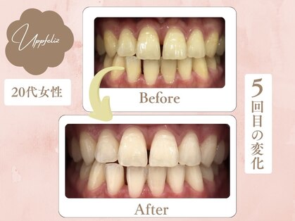 アップフェリス(Uppfeliz)の写真