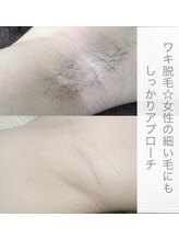 アンジュディ(A'nJUDY)/脱毛　ビフォーアフター