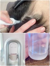 リジュベネ(rejuvena)/頭皮洗浄でニオイフケ予防