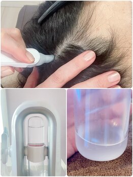 リジュベネ(rejuvena)/頭皮洗浄でニオイフケ予防