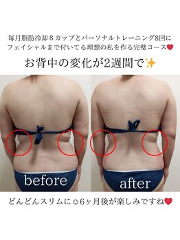 ホワイトビューティーラボ(White Beauty Lab)/【痩身】２週間で・・・