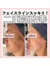 人気NO４【たるみ改善】フェイスラインスッキリ小顔コース！￥19800→￥12000