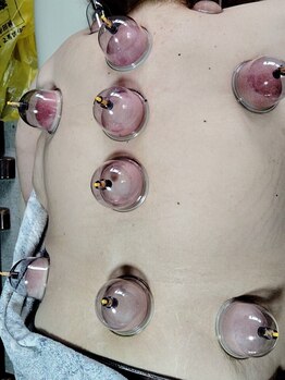 浄化整体院 雅葦の写真/目の奥の辛い”眼精疲労”や重くてガチガチに凝り固まった”肩こり”にも、根本から的確なアプローチ！