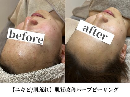 モンレーヴ(MonReve)の写真