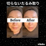 アッヴェリーレ(A'bbellire)