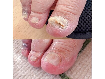 モコ(MOCO)の写真