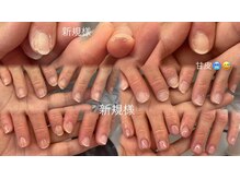 ビーティーサンキューネイル(BT39_Nail)/