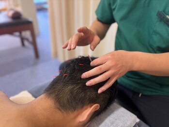 あき鍼灸整骨院/美髪鍼